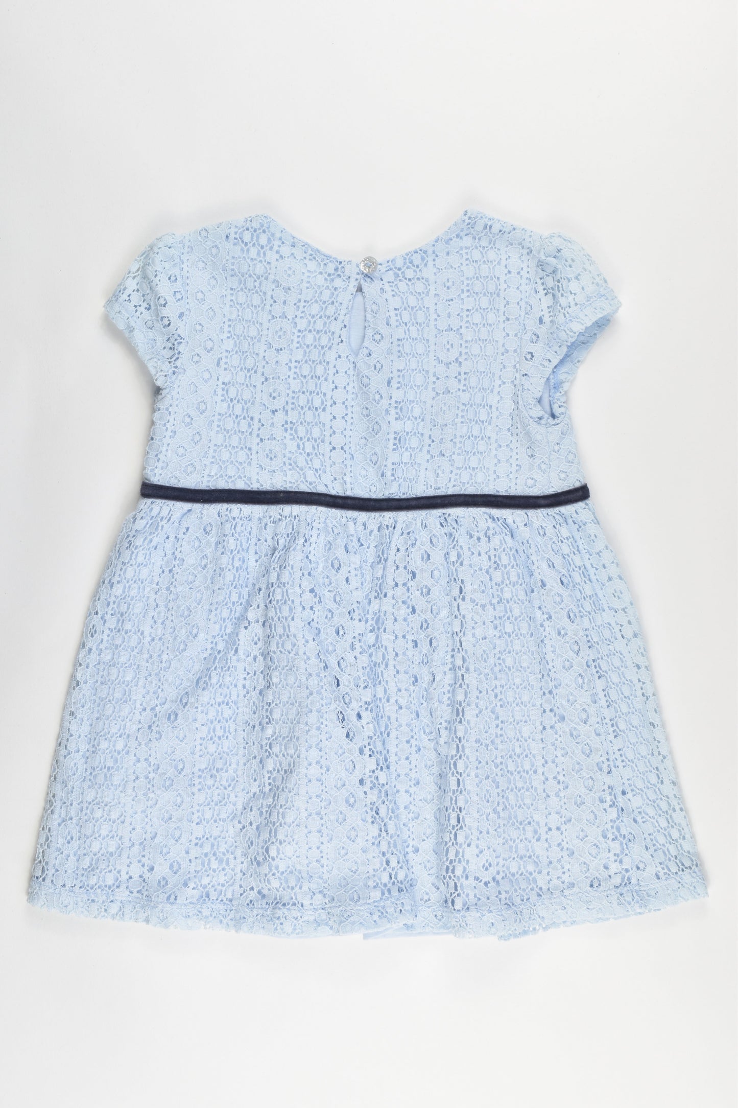 H&M Size 2 Lace Dress