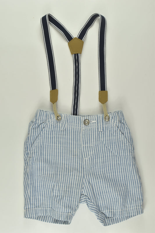 H&M Size 0 Suspender Shorts