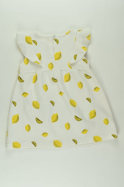 Zara Size 1 Lemon Dress