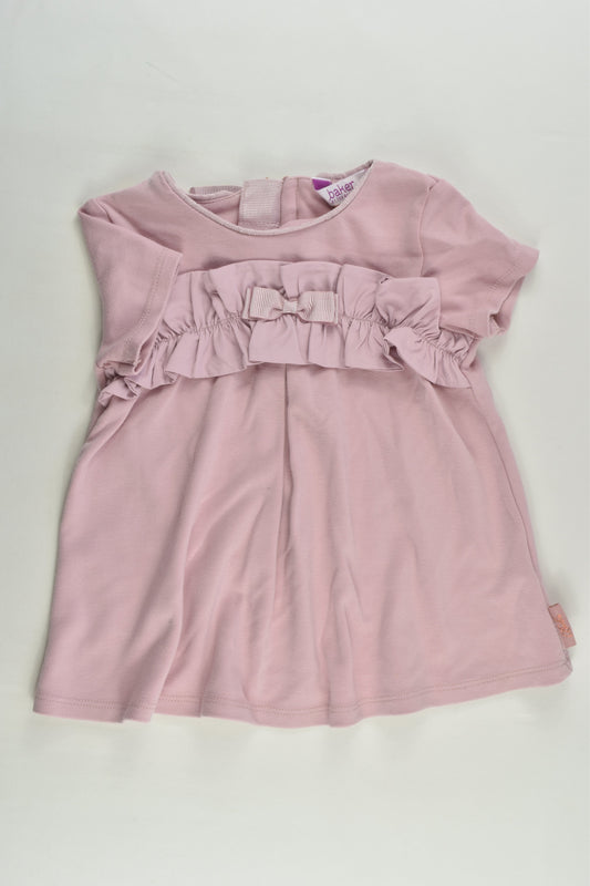 Baker by Ted Baker Size 1-2 (18-24 months) Dress/Tunic