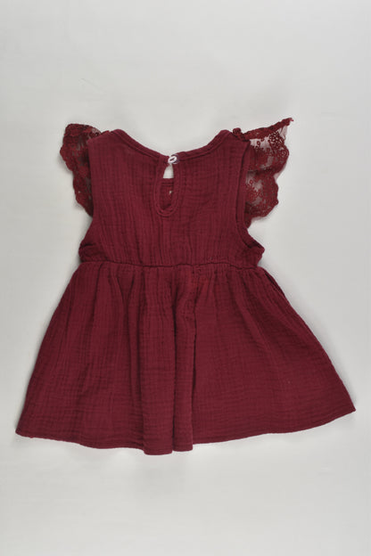 Brand Unknown Size approx 00 (70 cm) Muslin Dress
