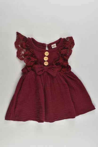 Brand Unknown Size approx 00 (70 cm) Muslin Dress