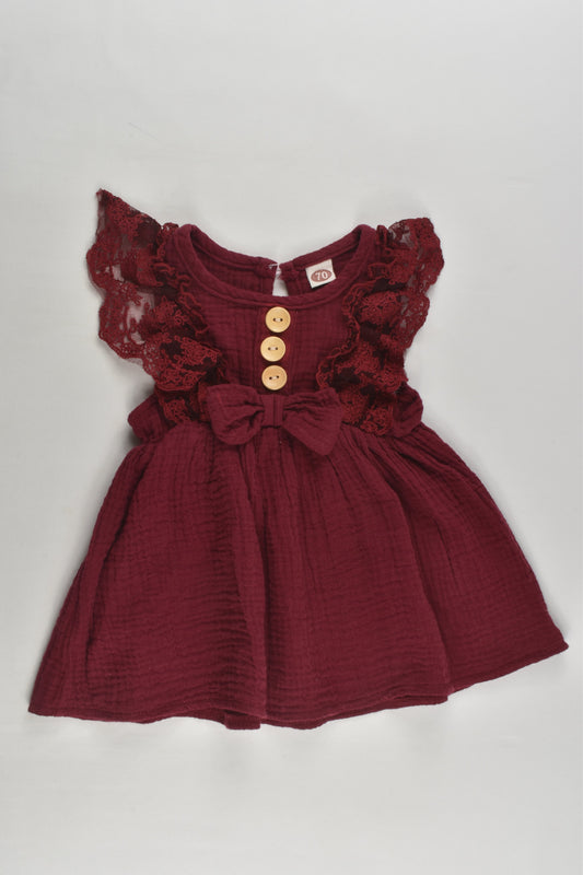 Brand Unknown Size approx 00 (70 cm) Muslin Dress