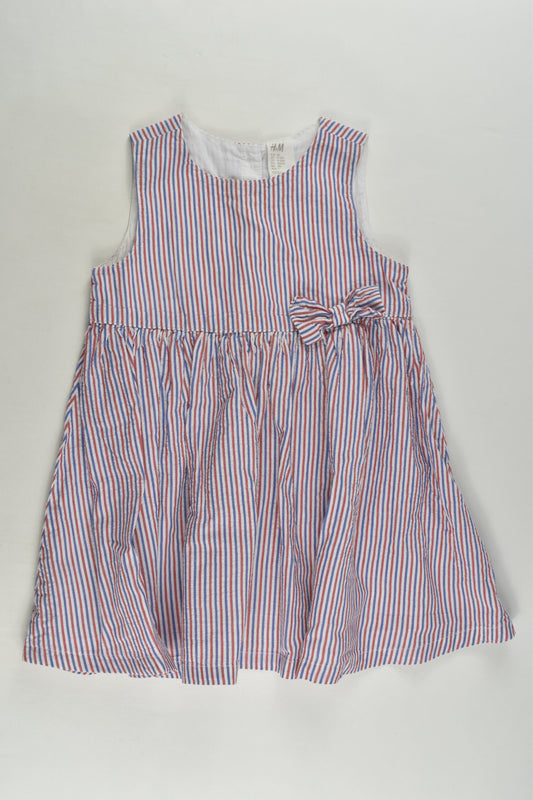 H&M Size 1 Striped Dress