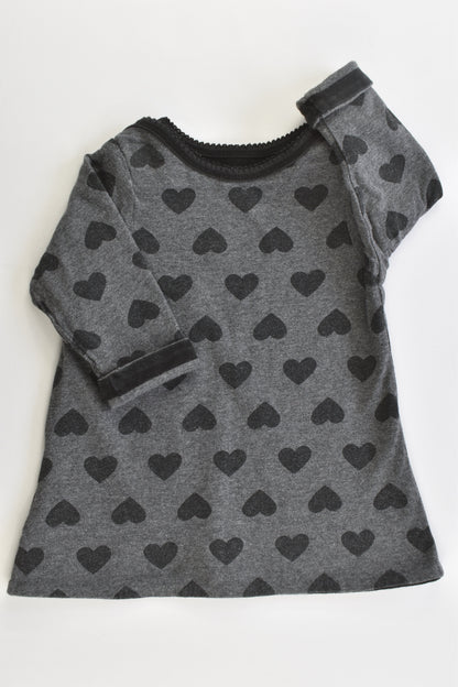 Gap Size 0 (6-12 months) Reversible Stripes/Love Hearts Top/Tunic