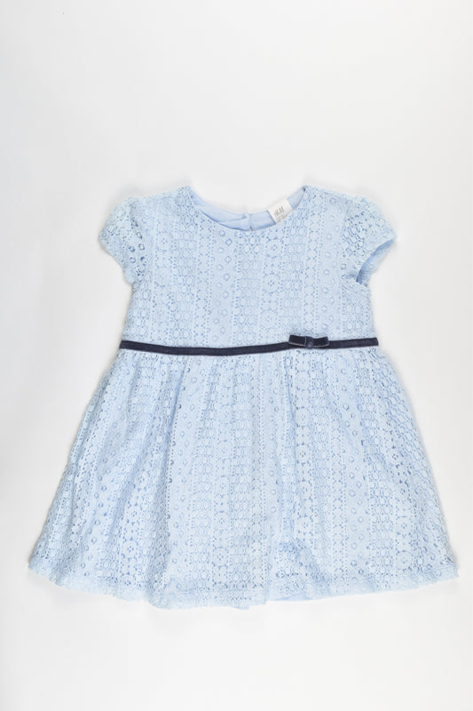 H&M Size 2 Lace Dress
