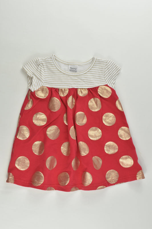 Teeny Weeny Size 00 (3-6 months, 68 cm) Polka Dots and Stripes Dress