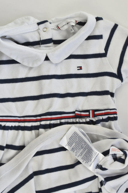 Tommy Hilfiger Size 1 (86 cm) Striped Dress