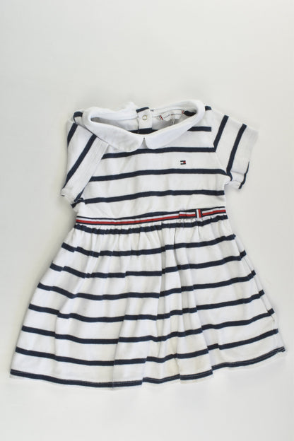 Tommy Hilfiger Size 1 (86 cm) Striped Dress