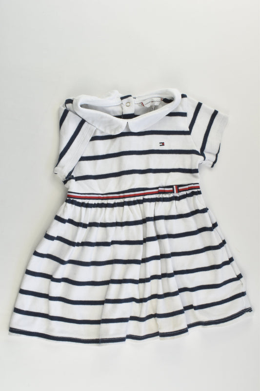 Tommy Hilfiger Size 1 (86 cm) Striped Dress